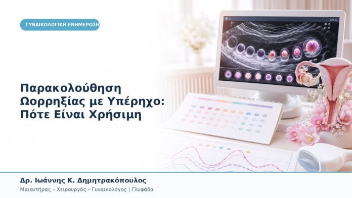 Παρακολούθηση Ωορρηξίας με Υπέρηχο: Πότε Είναι Χρήσιμη Παρακολούθηση Ωορρηξίας με Υπέρηχο: Πότε Είναι Χρήσιμη