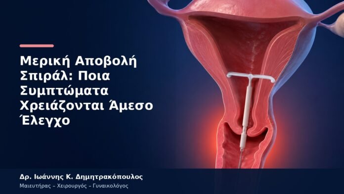 Μερική Αποβολή Σπιράλ: Ποια Συμπτώματα Χρειάζονται Άμεσο Έλεγχο Μερική Αποβολή Σπιράλ: Ποια Συμπτώματα Χρειάζονται Άμεσο Έλεγχο