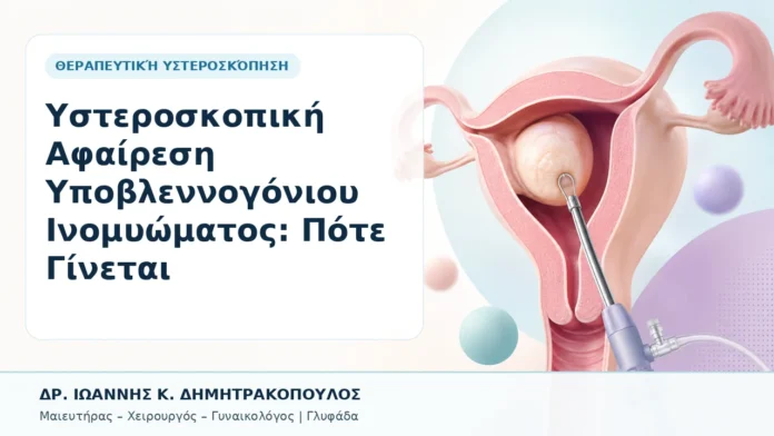 Υστεροσκοπική Αφαίρεση Υποβλεννογόνιου Ινομυώματος: Πότε Γίνεται - Δρ. Ιωάννης Κ. Δημητρακόπουλος, Γυναικολόγος Γλυφάδα