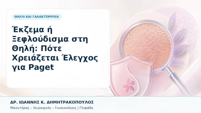 Έκζεμα ή Ξεφλούδισμα στη Θηλή: Πότε Χρειάζεται Έλεγχος για Paget - Δρ. Ιωάννης Κ. Δημητρακόπουλος, Γυναικολόγος Γλυφάδα