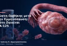 Κύστη Ωοθήκης μετά την Εμμηνόπαυση: Πότε Ζητείται CA-125 Κύστη Ωοθήκης μετά την Εμμηνόπαυση: Πότε Ζητείται CA-125