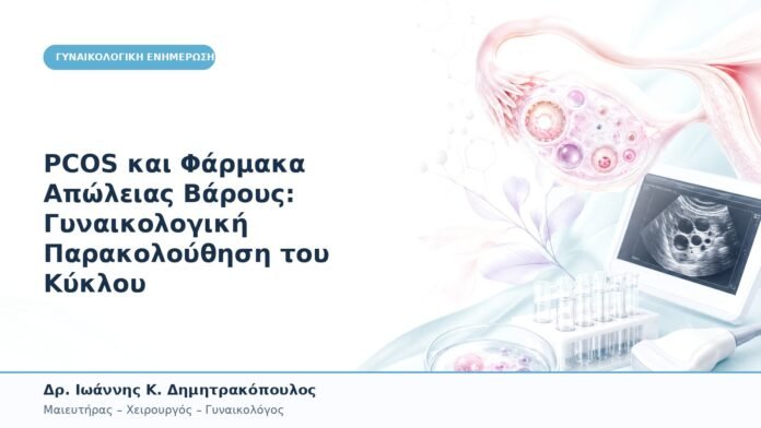 PCOS και Φάρμακα Απώλειας Βάρους: Γυναικολογική Παρακολούθηση του Κύκλου