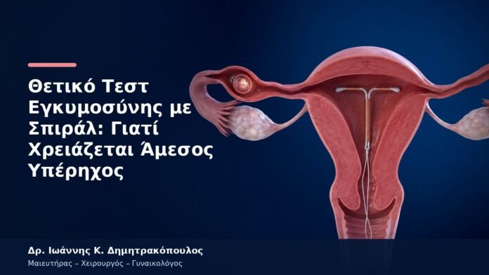 Θετικό Τεστ Εγκυμοσύνης με Σπιράλ: Γιατί Χρειάζεται Άμεσος Υπέρηχος Θετικό Τεστ Εγκυμοσύνης με Σπιράλ: Γιατί Χρειάζεται Άμεσος Υπέρηχος