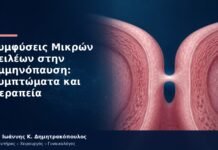 Συμφύσεις Μικρών Χειλέων στην Εμμηνόπαυση: Συμπτώματα και Θεραπεία Συμφύσεις Μικρών Χειλέων στην Εμμηνόπαυση: Συμπτώματα και Θεραπεία