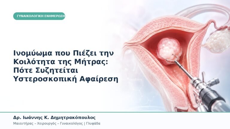Ινομύωμα που Πιέζει την Κοιλότητα της Μήτρας: Πότε Συζητείται Υστεροσκοπική Αφαίρεση