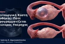 Λειτουργική Κύστη Ωοθήκης: Πότε Προγραμματίζεται Δεύτερος Υπέρηχος Λειτουργική Κύστη Ωοθήκης: Πότε Προγραμματίζεται Δεύτερος Υπέρηχος