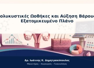 Πολυκυστικές Ωοθήκες και Αύξηση Βάρους: Εξατομικευμένο Πλάνο