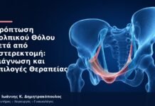 Πρόπτωση Κολπικού Θόλου μετά από Υστερεκτομή: Διάγνωση και Επιλογές Θεραπείας