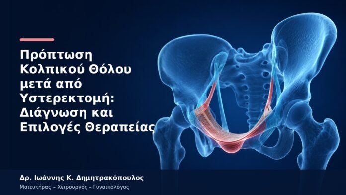 Πρόπτωση Κολπικού Θόλου μετά από Υστερεκτομή: Διάγνωση και Επιλογές Θεραπείας Πρόπτωση Κολπικού Θόλου μετά από Υστερεκτομή: Διάγνωση και Επιλογές Θεραπείας