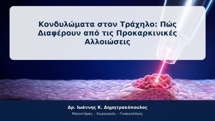 Κονδυλώματα στον Τράχηλο: Πώς Διαφέρουν από τις Προκαρκινικές Αλλοιώσεις Κονδυλώματα στον Τράχηλο: Πώς Διαφέρουν από τις Προκαρκινικές Αλλοιώσεις