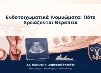 Ενδοτοιχωματικά Ινομυώματα: Πότε Χρειάζονται Θεραπεία