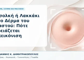 Εισολκή ή Λακκάκι στο Δέρμα του Μαστού: Πότε Χρειάζεται Απεικόνιση Εισολκή ή Λακκάκι στο Δέρμα του Μαστού: Πότε Χρειάζεται Απεικόνιση - Δρ. Ιωάννης Κ. Δημητρακόπουλος, Γυναικολόγος Γλυφάδα