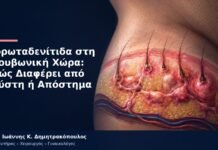 Ιδρωταδενίτιδα στη Βουβωνική Χώρα: Πώς Διαφέρει από Κύστη ή Απόστημα