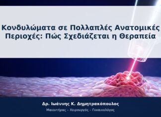 Κονδυλώματα σε Πολλαπλές Ανατομικές Περιοχές: Πώς Σχεδιάζεται η Θεραπεία