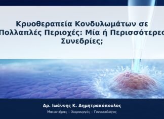 Κρυοθεραπεία Κονδυλωμάτων σε Πολλαπλές Περιοχές: Μία ή Περισσότερες Συνεδρίες; Κρυοθεραπεία Κονδυλωμάτων σε Πολλαπλές Περιοχές: Μία ή Περισσότερες Συνεδρίες;