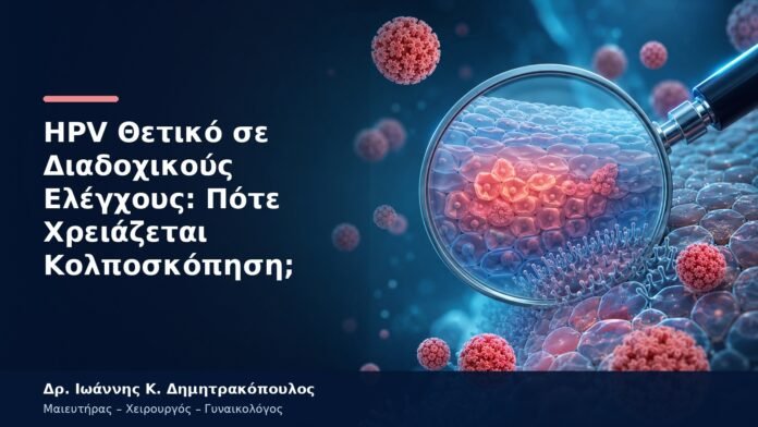 HPV Θετικό σε Διαδοχικούς Ελέγχους: Πότε Χρειάζεται Κολποσκόπηση; HPV Θετικό σε Διαδοχικούς Ελέγχους: Πότε Χρειάζεται Κολποσκόπηση;