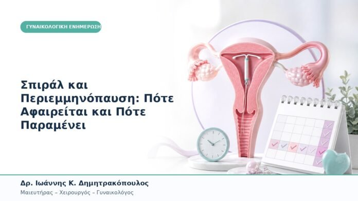Σπιράλ και Περιεμμηνόπαυση: Πότε Αφαιρείται και Πότε Παραμένει Σπιράλ και Περιεμμηνόπαυση: Πότε Αφαιρείται και Πότε Παραμένει