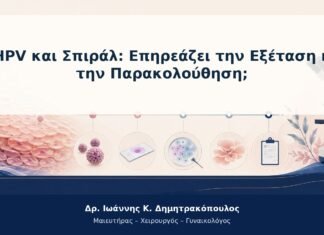 HPV και Σπιράλ: Επηρεάζει την Εξέταση ή την Παρακολούθηση; HPV και Σπιράλ: Επηρεάζει την Εξέταση ή την Παρακολούθηση;