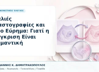 Παλιές Μαστογραφίες και Νέο Εύρημα: Γιατί η Σύγκριση Είναι Σημαντική Παλιές Μαστογραφίες και Νέο Εύρημα: Γιατί η Σύγκριση Είναι Σημαντική - Δρ. Ιωάννης Κ. Δημητρακόπουλος, Γυναικολόγος Γλυφάδα
