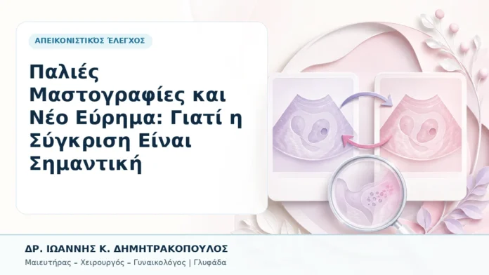 030-palies-mastografies-kai-neo-eyrima-giati-i-sygkrisi-einai-simantiki Παλιές Μαστογραφίες και Νέο Εύρημα: Γιατί η Σύγκριση Είναι Σημαντική - Δρ. Ιωάννης Κ. Δημητρακόπουλος, Γυναικολόγος Γλυφάδα