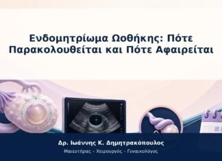 Ενδομητρίωμα Ωοθήκης: Πότε Παρακολουθείται και Πότε Αφαιρείται Ενδομητρίωμα Ωοθήκης: Πότε Παρακολουθείται και Πότε Αφαιρείται