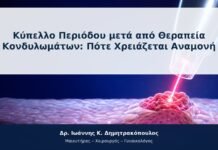 Κύπελλο Περιόδου μετά από Θεραπεία Κονδυλωμάτων: Πότε Χρειάζεται Αναμονή