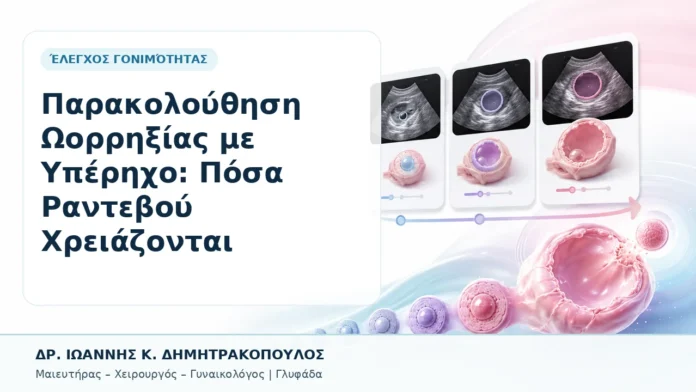 Παρακολούθηση Ωορρηξίας με Υπέρηχο: Πόσα Ραντεβού Χρειάζονται - Δρ. Ιωάννης Κ. Δημητρακόπουλος, Γυναικολόγος Γλυφάδα