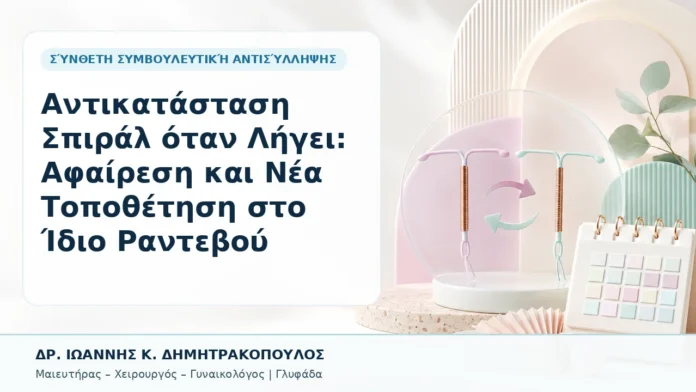 Αντικατάσταση Σπιράλ όταν Λήγει: Αφαίρεση και Νέα Τοποθέτηση στο Ίδιο Ραντεβού - Δρ. Ιωάννης Κ. Δημητρακόπουλος, Γυναικολόγος Γλυφάδα