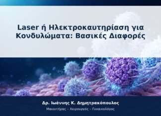 Laser ή Ηλεκτροκαυτηρίαση για Κονδυλώματα: Βασικές Διαφορές Laser ή Ηλεκτροκαυτηρίαση για Κονδυλώματα: Βασικές Διαφορές