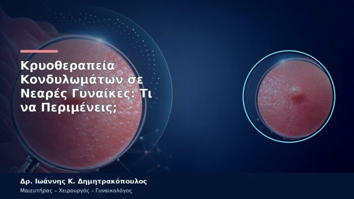 Κρυοθεραπεία Κονδυλωμάτων σε Νεαρές Γυναίκες: Τι να Περιμένεις; Κρυοθεραπεία Κονδυλωμάτων σε Νεαρές Γυναίκες: Τι να Περιμένεις;