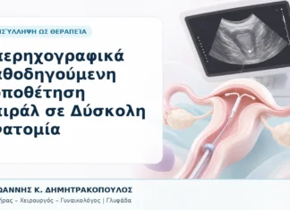 Υπερηχογραφικά Καθοδηγούμενη Τοποθέτηση Σπιράλ σε Δύσκολη Ανατομία Υπερηχογραφικά Καθοδηγούμενη Τοποθέτηση Σπιράλ σε Δύσκολη Ανατομία - Δρ. Ιωάννης Κ. Δημητρακόπουλος, Γυναικολόγος Γλυφάδα