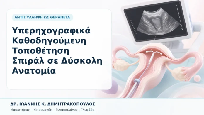 043-yperichografika-kathodigoymeni-topothetisi-spiral-se-dyskoli-anatomia Υπερηχογραφικά Καθοδηγούμενη Τοποθέτηση Σπιράλ σε Δύσκολη Ανατομία - Δρ. Ιωάννης Κ. Δημητρακόπουλος, Γυναικολόγος Γλυφάδα