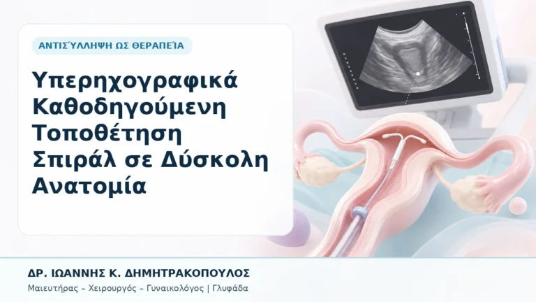 Υπερηχογραφικά Καθοδηγούμενη Τοποθέτηση Σπιράλ σε Δύσκολη Ανατομία - Δρ. Ιωάννης Κ. Δημητρακόπουλος, Γυναικολόγος Γλυφάδα