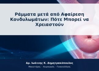 Ράμματα μετά από Αφαίρεση Κονδυλωμάτων: Πότε Μπορεί να Χρειαστούν Ράμματα μετά από Αφαίρεση Κονδυλωμάτων: Πότε Μπορεί να Χρειαστούν