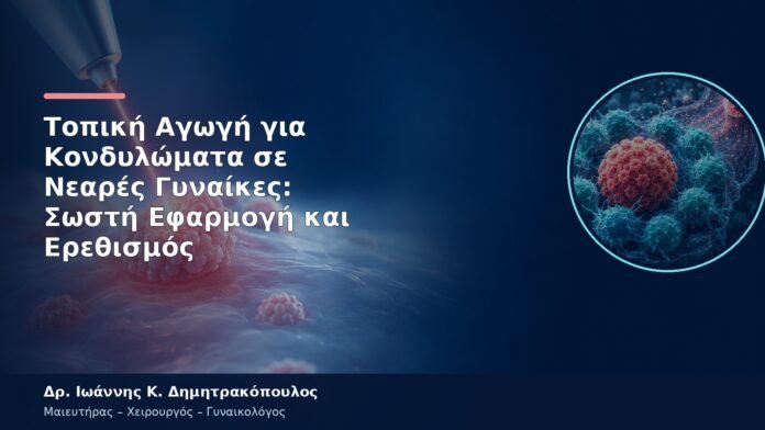 Τοπική Αγωγή για Κονδυλώματα σε Νεαρές Γυναίκες: Σωστή Εφαρμογή και Ερεθισμός Τοπική Αγωγή για Κονδυλώματα σε Νεαρές Γυναίκες: Σωστή Εφαρμογή και Ερεθισμός