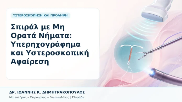 047-spiral-me-mi-orata-nimata-yperichografima-kai-ysteroskopiki-afairesi Σπιράλ με Μη Ορατά Νήματα: Υπερηχογράφημα και Υστεροσκοπική Αφαίρεση - Δρ. Ιωάννης Κ. Δημητρακόπουλος, Γυναικολόγος Γλυφάδα