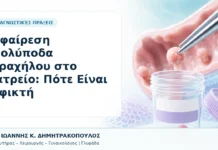 Αφαίρεση Πολύποδα Τραχήλου στο Ιατρείο: Πότε Είναι Εφικτή Αφαίρεση Πολύποδα Τραχήλου στο Ιατρείο: Πότε Είναι Εφικτή - Δρ. Ιωάννης Κ. Δημητρακόπουλος, Γυναικολόγος Γλυφάδα