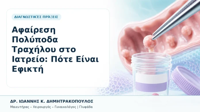 049-afairesi-polypoda-trachiloy-sto-iatreio-pote-einai-efikti Αφαίρεση Πολύποδα Τραχήλου στο Ιατρείο: Πότε Είναι Εφικτή - Δρ. Ιωάννης Κ. Δημητρακόπουλος, Γυναικολόγος Γλυφάδα