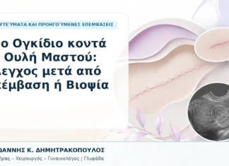 Νέο Ογκίδιο κοντά σε Ουλή Μαστού: Έλεγχος μετά από Επέμβαση ή Βιοψία Νέο Ογκίδιο κοντά σε Ουλή Μαστού: Έλεγχος μετά από Επέμβαση ή Βιοψία - Δρ. Ιωάννης Κ. Δημητρακόπουλος, Γυναικολόγος Γλυφάδα