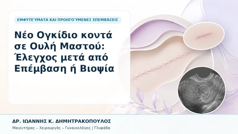 Νέο Ογκίδιο κοντά σε Ουλή Μαστού: Έλεγχος μετά από Επέμβαση ή Βιοψία - Δρ. Ιωάννης Κ. Δημητρακόπουλος, Γυναικολόγος Γλυφάδα