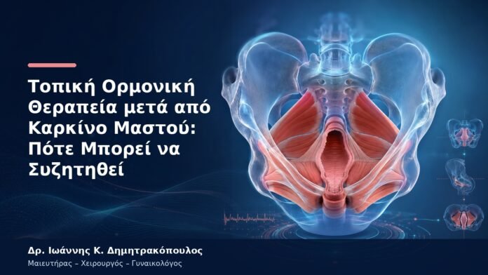 Τοπική Ορμονική Θεραπεία μετά από Καρκίνο Μαστού: Πότε Μπορεί να Συζητηθεί Τοπική Ορμονική Θεραπεία μετά από Καρκίνο Μαστού: Πότε Μπορεί να Συζητηθεί