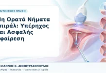 Μη Ορατά Νήματα Σπιράλ: Υπέρηχος και Ασφαλής Αφαίρεση Μη Ορατά Νήματα Σπιράλ: Υπέρηχος και Ασφαλής Αφαίρεση - Δρ. Ιωάννης Κ. Δημητρακόπουλος, Γυναικολόγος Γλυφάδα