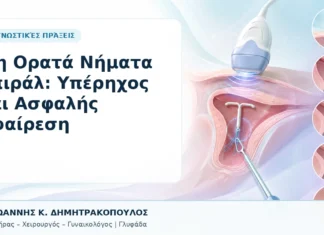 Μη Ορατά Νήματα Σπιράλ: Υπέρηχος και Ασφαλής Αφαίρεση Μη Ορατά Νήματα Σπιράλ: Υπέρηχος και Ασφαλής Αφαίρεση - Δρ. Ιωάννης Κ. Δημητρακόπουλος, Γυναικολόγος Γλυφάδα