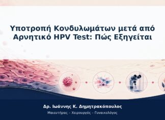 Υποτροπή Κονδυλωμάτων μετά από Αρνητικό HPV Test: Πώς Εξηγείται Υποτροπή Κονδυλωμάτων μετά από Αρνητικό HPV Test: Πώς Εξηγείται