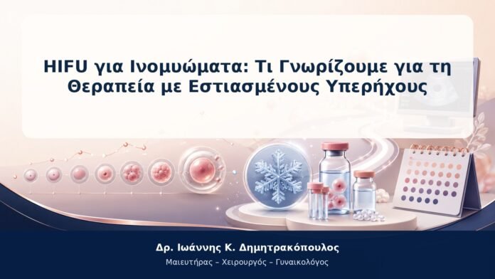 HIFU για Ινομυώματα: Τι Γνωρίζουμε για τη Θεραπεία με Εστιασμένους Υπερήχους