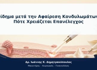 Οίδημα μετά την Αφαίρεση Κονδυλωμάτων: Πότε Χρειάζεται Επανέλεγχος