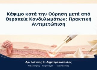 Κάψιμο κατά την Ούρηση μετά από Θεραπεία Κονδυλωμάτων: Πρακτική Αντιμετώπιση