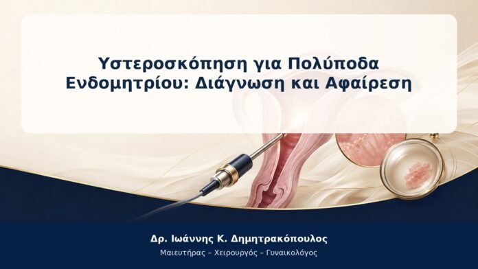 Υστεροσκόπηση για Πολύποδα Ενδομητρίου: Διάγνωση και Αφαίρεση Υστεροσκόπηση για Πολύποδα Ενδομητρίου: Διάγνωση και Αφαίρεση