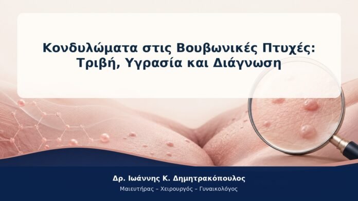 Κονδυλώματα στις Βουβωνικές Πτυχές: Τριβή, Υγρασία και Διάγνωση