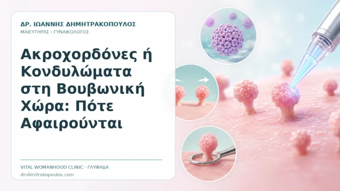 Ακροχορδόνες ή Κονδυλώματα στη Βουβωνική Χώρα: Πότε Αφαιρούνται Ακροχορδόνες ή Κονδυλώματα στη Βουβωνική Χώρα: Πότε Αφαιρούνται - Δρ. Ιωάννης Δημητρακόπουλος, Γυναικολόγος Γλυφάδα